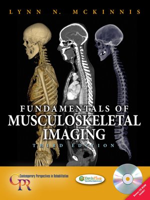 cover image of Fundamentals of Musculoskeletal Imaging